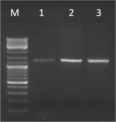 Structural Characterization of the Highly Restricted Down Syndrome Critical Region on 21q22.13: New KCNJ6 and DSCR4 Transcript Isoforms